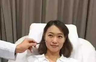 自体脂肪填充术