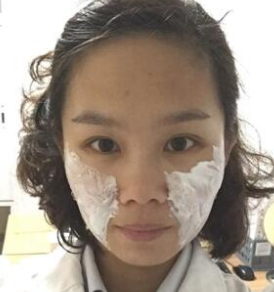 面部提升术