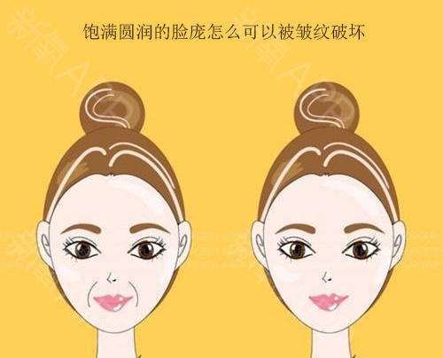 自体脂肪填充术