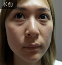 超级微拉美