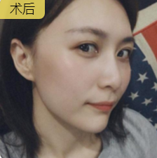 超级微拉美