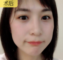 超级微拉美
