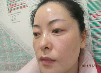 超级微拉美