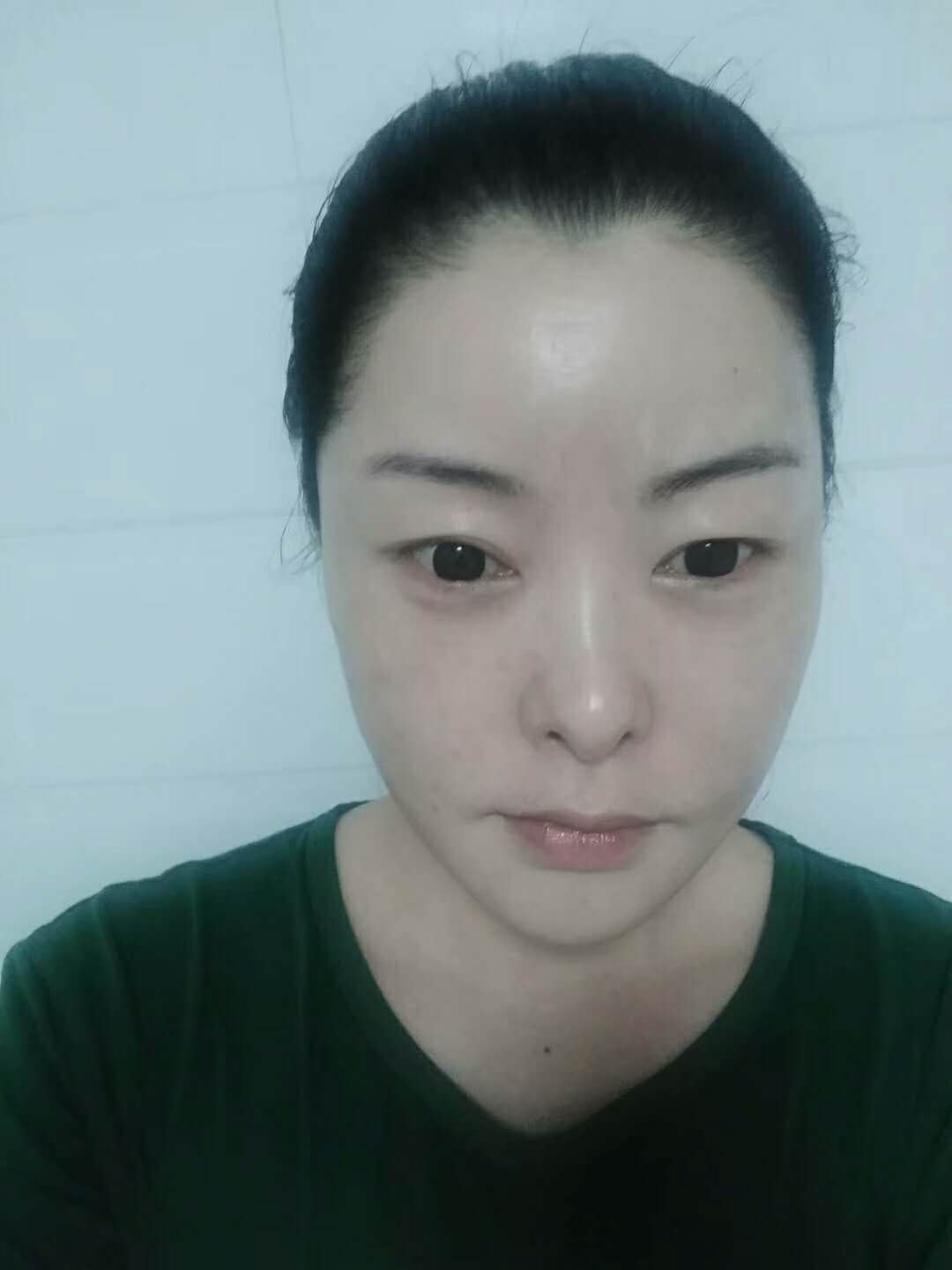 超级微拉美