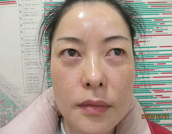 超级微拉美