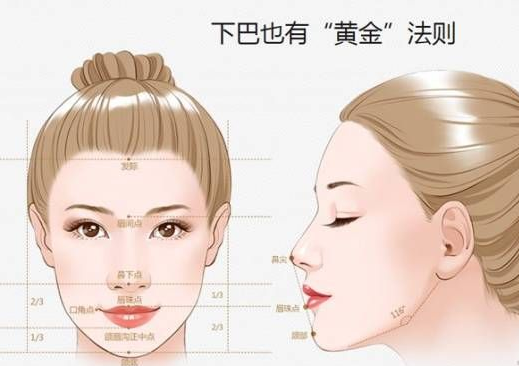 隆下巴