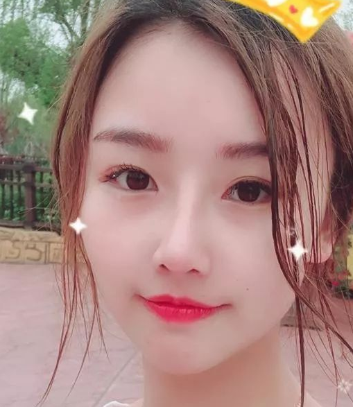 隆鼻手术