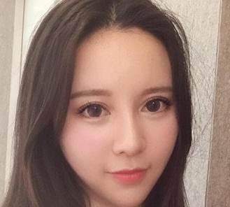 双眼皮手术