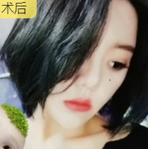 超级微拉美