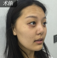 超级微拉美