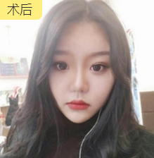 超级微拉美