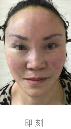 超级微拉美