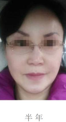 超级微拉美