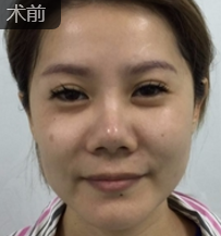 超级微拉美