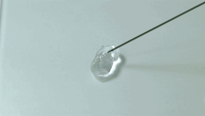 玻尿酸填充术