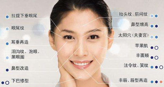 玻尿酸填充术