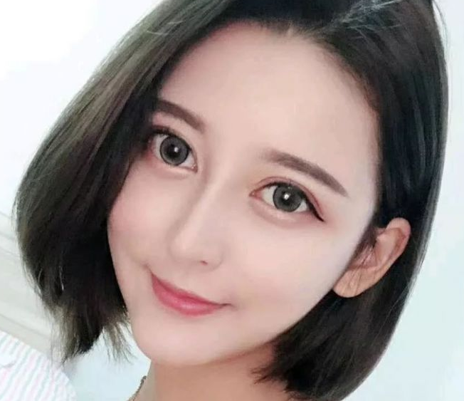 自体脂肪填充术