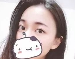 自体脂肪填充术