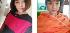 双眼皮手术