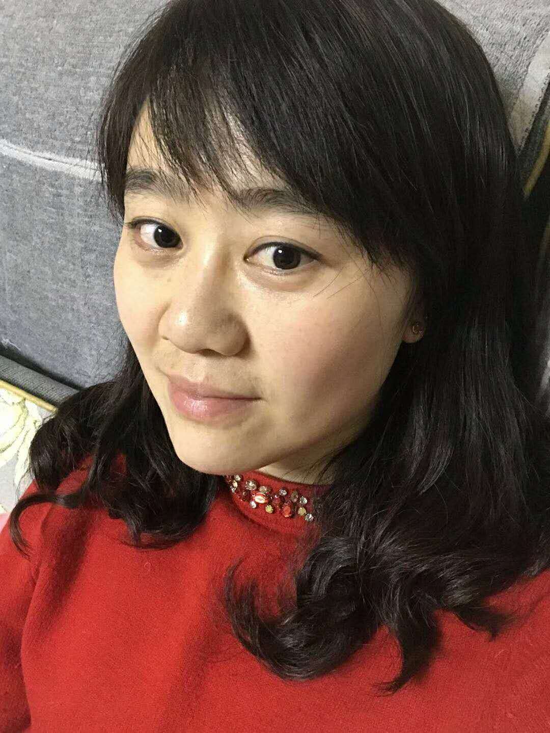 长效玻尿酸填充泪沟