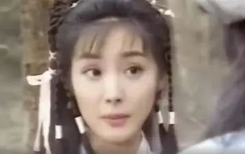 双眼皮手术