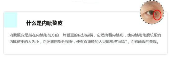 双眼皮手术