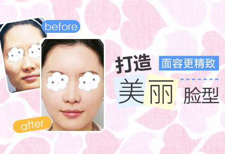 自体脂肪填充术