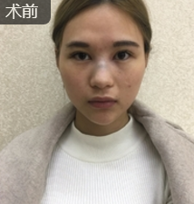 超级微拉美