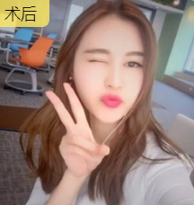 超级微拉美