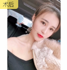 超级微拉美