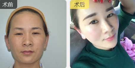 超级微拉美
