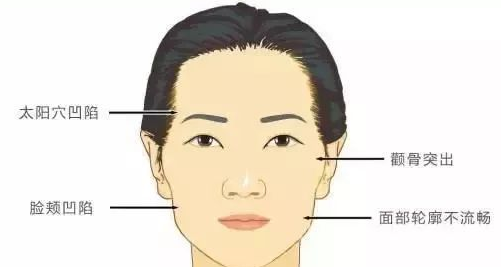 自体脂肪填充术