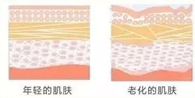 自体脂肪填充术