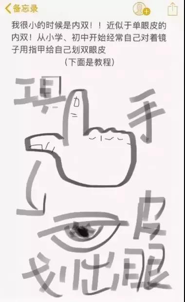 双眼皮手术