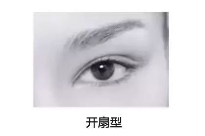 双眼皮手术