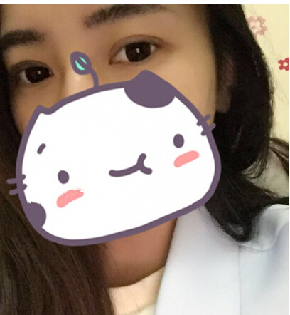 双眼皮手术