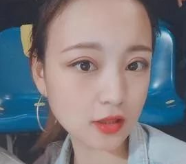 双眼皮手术
