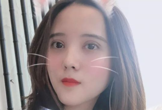 双眼皮手术