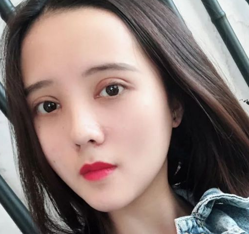 双眼皮手术