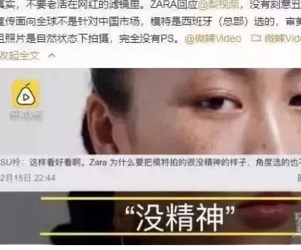 双眼皮手术