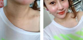 超级微拉美