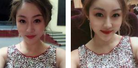 超级微拉美