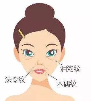 玻尿酸填充术