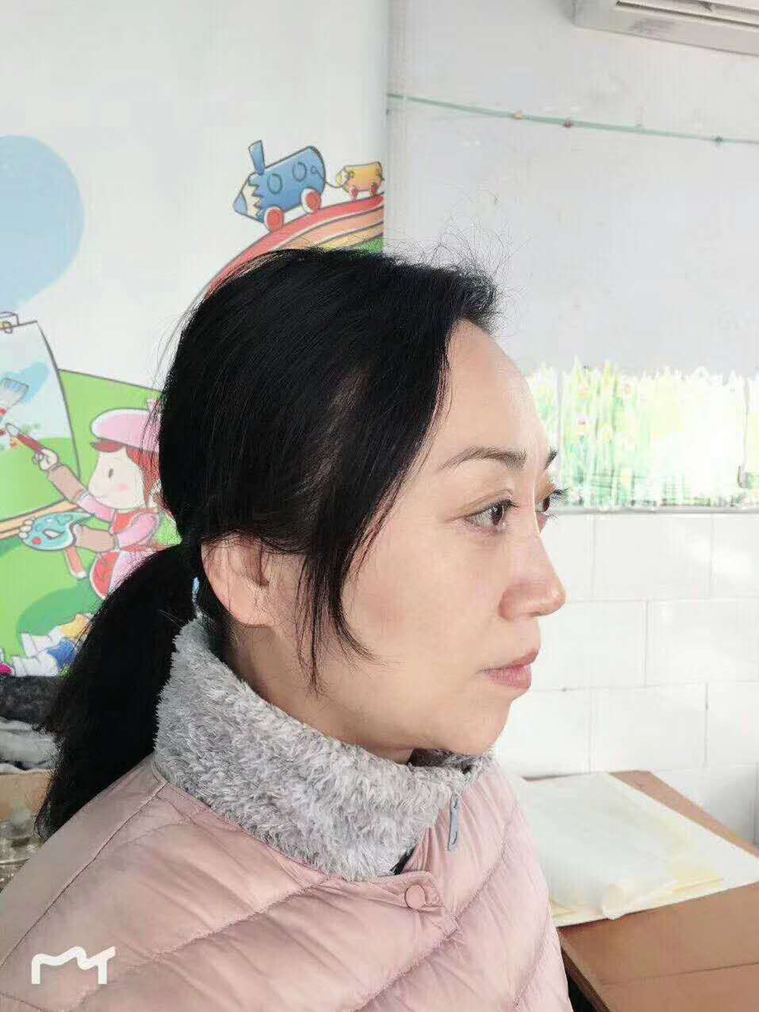 超声波去袋