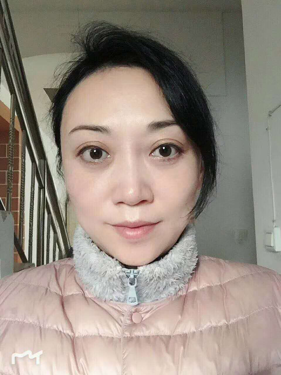 超声波去眼袋