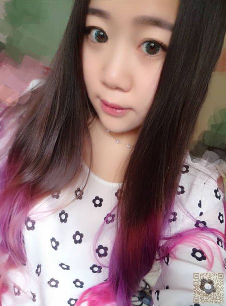 超声波双眼皮