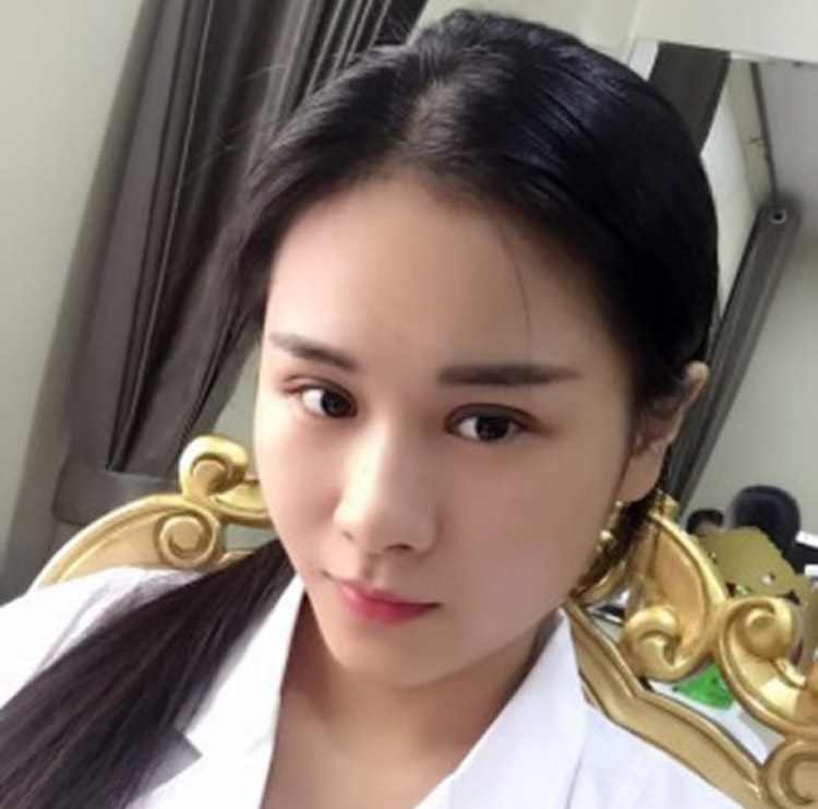 超声波双眼皮