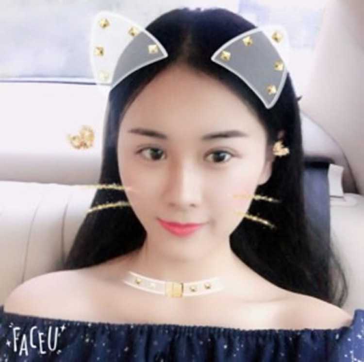 超声波双眼皮
