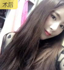 超级微拉美