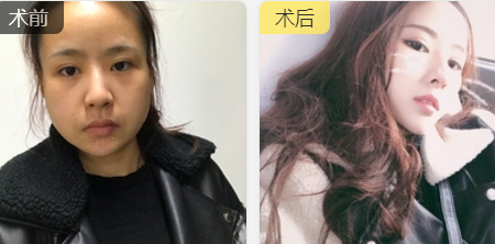 超级微拉美